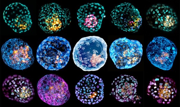 Stamcelembryos-credits-Monash-University